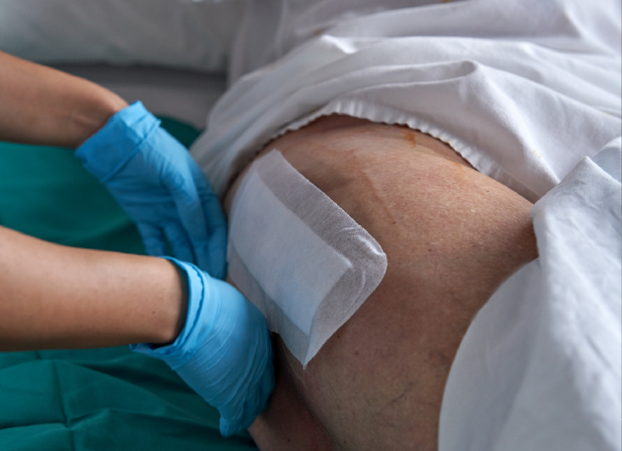 Lymphedema and Wounds