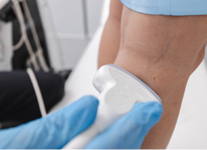 View category: Venous Disease Care